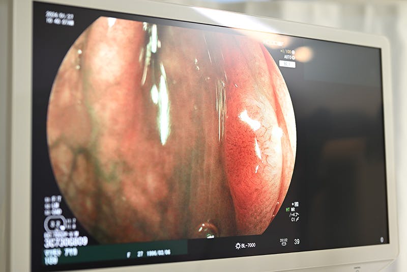 下北沢メディカル 内科・消化器内視鏡クリニックのAI診断の画像